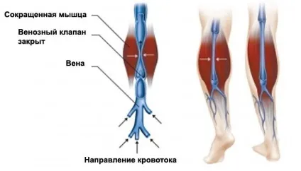 Подушка варіфорт від варикозу міфи і правда (варіфорт) Подушка варіфорт від варикозу міфи і правда