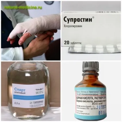 Допомога при опіках від рослин (Які рослини залишають опіки) Допомога при опіках від рослин