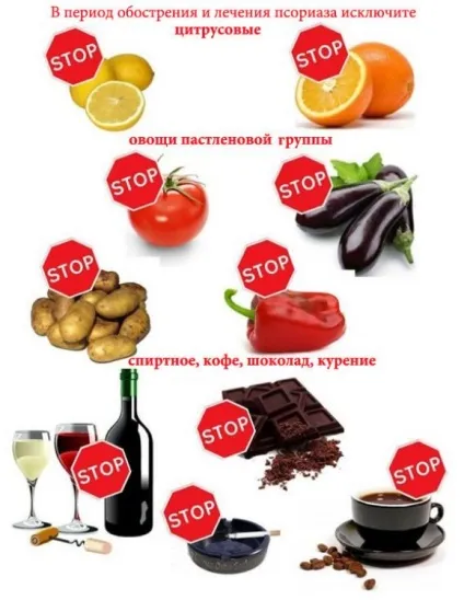 Правила життя при псоріазі