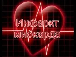 Передвісники інфаркту, здрава