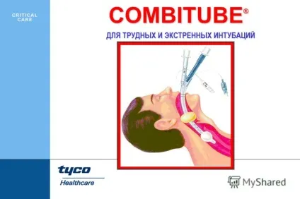Презентація на тему combitube - для важких і екстрених інтубацій (австрія. Він встановив.) Презентація на тему combitube - для важких і екстрених інтубацій