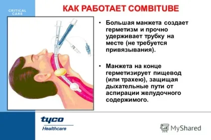 Презентація на тему combitube - для важких і екстрених інтубацій (combitube ® для важких і екстрених інтубацій. Вперше впроваджена в 1987 р професором michael frass з університетській клініці вени) Презентація на тему combitube - для важких і екстрених інтубацій