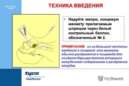 Презентація на тему combitube - для важких і екстрених інтубацій (тему) Презентація на тему combitube - для важких і екстрених інтубацій