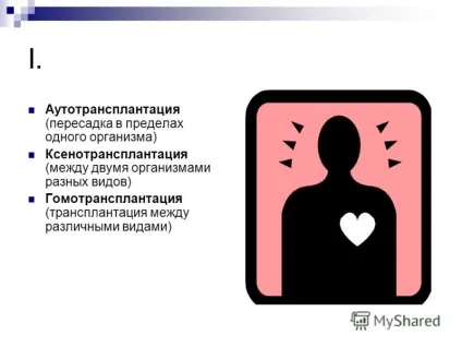 Презентація на тему трансплантація органів і тканин (органів) Презентація на тему трансплантація органів і тканин