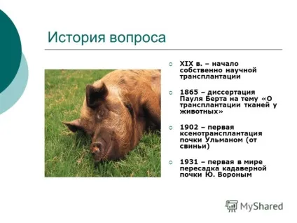 Презентація на тему трансплантація органів і тканин (тему) Презентація на тему трансплантація органів і тканин
