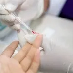 Ознаки хворих нирок у жінок і чоловіків симптоми і лікування (хворих) Ознаки хворих нирок у жінок і чоловіків симптоми і лікування