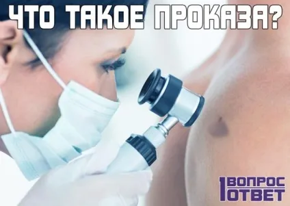 Проказа що це хвороба фото, опис, симптоми (Мало хто знає таке) Проказа що це хвороба фото, опис, симптоми