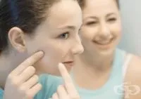 Як позбутися від білих точок на обличчі (особі) Як позбутися від білих точок на обличчі