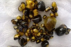 Які продукти харчування самі жовчогінні, список (перелік) продуктів (жовчогінні) Які продукти харчування самі жовчогінні, список (перелік) продуктів