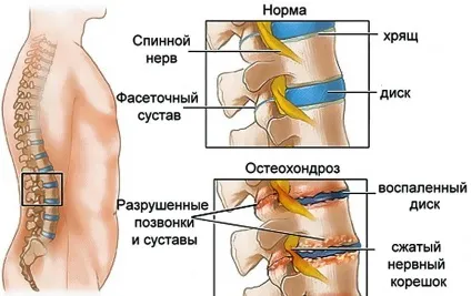 Простріли в нозі причини