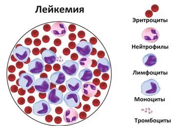 Радіоактивне опромінення людини види, вплив на організм