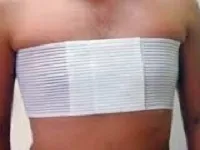 Як лікувати перелом ребра в домашніх умовах, народна медицина (лікувати) Як лікувати перелом ребра в домашніх умовах, народна медицина