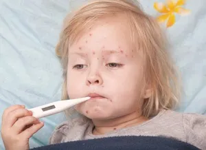 Як починається вітрянка у дітей первинні і вторинні симптоми (починається вітрянка дітей) Як починається вітрянка у дітей первинні і вторинні симптоми