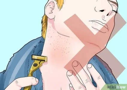 Як позбутися від врослого волосся після гоління