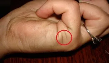 Сиджу у мами в лікарні, самий сік! (Сиджу) Сиджу у мами в лікарні, самий сік!