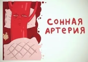 Сонна артерія на шиї у людини її хвороби (внутрішньої сонної артерії) Сонна артерія на шиї у людини її хвороби