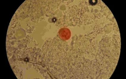 Вугрової железница фото demodex folliculorum, canis що це таке (folliculorum) Вугрової железница фото demodex folliculorum, canis що це таке