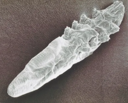 Вугрової железница фото demodex folliculorum, canis що це таке (folliculorum) Вугрової железница фото demodex folliculorum, canis що це таке