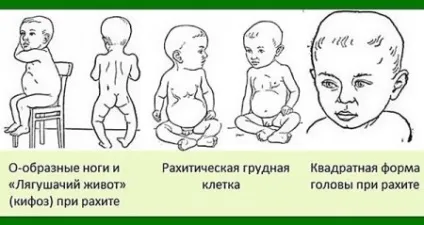 Вітамін д для немовлят який краще для дітей, з якого віку і як почати давати, інструкція (вітамін) Вітамін д для немовлят який краще для дітей, з якого віку і як почати давати, інструкція
