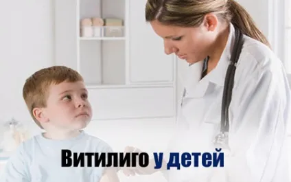 Вітіліго у дітей причини, лікування на початковій стадії у немовляти і немовляти (вітіліго дітей різного віку) Вітіліго у дітей причини, лікування на початковій стадії у немовляти і немовляти