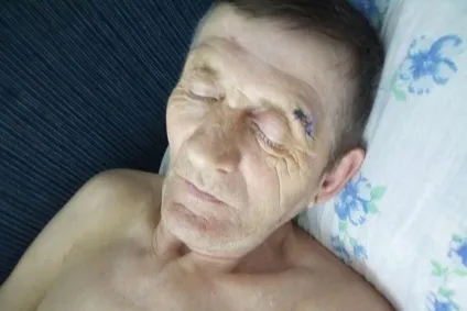 Лікарі втратили документи тяжкохворого і лікували його як бомжа (бомжа) Лікарі втратили документи тяжкохворого і лікували його як бомжа