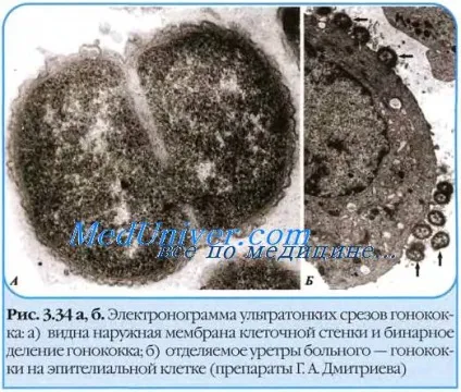 Збудники хірургічних інфекцій (збудники хірургічних інфекцій) Збудники хірургічних інфекцій