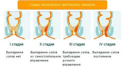 Змова від геморою правила проведення та шанс на одужання (правила) Змова від геморою правила проведення та шанс на одужання