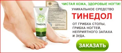 Грибок на п'ятах види, як виглядає, симптоми, лікування, креми та мазі (лікування) Грибок на п'ятах види, як виглядає, симптоми, лікування, креми та мазі
