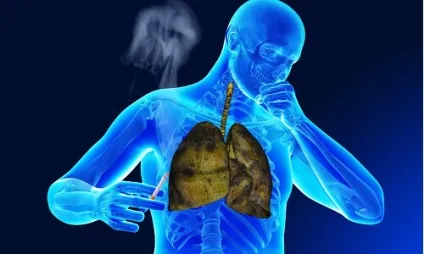 Як очистити легені від нікотину (легкі) Як очистити легені від нікотину