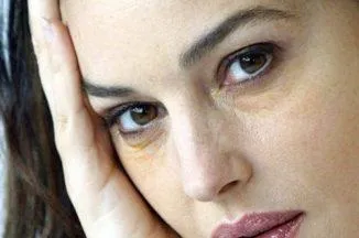 Жовті кола навколо очей у жінок причини виникнення, що означають, як лікувати (навколо) Жовті кола навколо очей у жінок причини виникнення, що означають, як лікувати