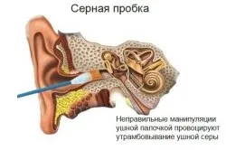 Свербіж і біль у вухах