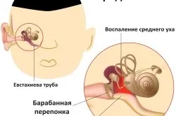 Свербіж і біль у вухах