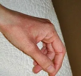 Сверблячка і почервоніння на руках - про що говорять ці симптоми, і як швидко позбутися від неприємних (симптоми) Сверблячка і почервоніння на руках - про що говорять ці симптоми, і як швидко позбутися від неприємних
