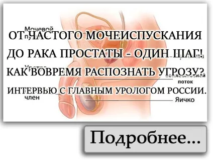 Як правильно носити кільце Як правильно носити кільце