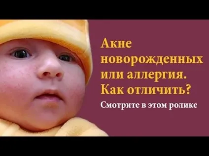 Алергія у грудничка