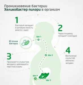 Антральний поверхневий гастрит причини, симптоми і лікування (симптоми) Антральний поверхневий гастрит причини, симптоми і лікування