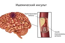 Біль і важкість у шлунку причини