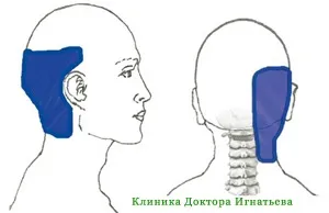 Болить потилицю голови праворуч причини (причини) Болить потилицю голови праворуч причини