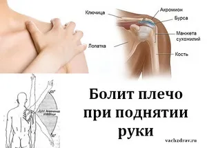 Біль у плечі важко підняти руку