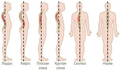 Болить потилицю голови праворуч причини (голови) Болить потилицю голови праворуч причини