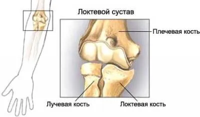 Біль в ліктьовому суглобі причини ниючий, гострої, сильної болі (суглобі) Біль в ліктьовому суглобі причини ниючий, гострої, сильної болі
