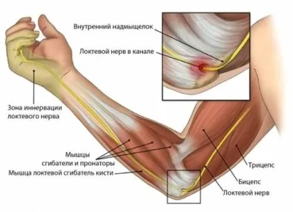 Біль в ліктьовому суглобі причини ниючий, гострої, сильної болі (біль) Біль в ліктьовому суглобі причини ниючий, гострої, сильної болі