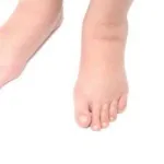 Чистка лімфи народними засобами