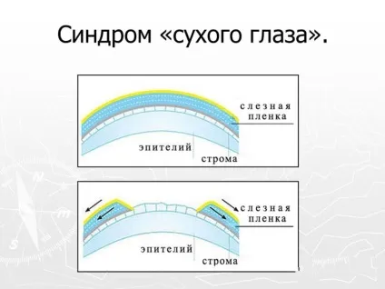 Що необхідно знати про татуаже очей (необхідно) Що необхідно знати про татуаже очей