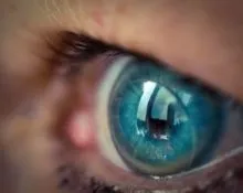 Що таке радіус кривизни в контактних лінзах - як дізнатися радіус