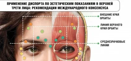 Диспорт на очі - про процедуру розгладження зморшок (очі) Диспорт на очі - про процедуру розгладження зморшок