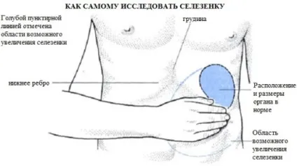 Дієта для селезінки (запаленні, збільшенні, видаленні) меню і рекомендації (збільшенні) Дієта для селезінки (запаленні, збільшенні, видаленні) меню і рекомендації