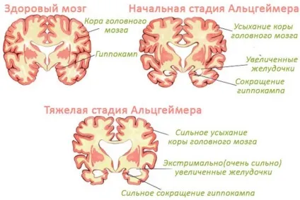 Діагностика захворювань головного мозку 1 (мозку) Діагностика захворювань головного мозку 1