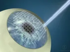 Фемто ЛАСІК (femto lasik) метод лазерної корекції зору (фемто ЛАСІК) Фемто ЛАСІК (femto lasik) метод лазерної корекції зору