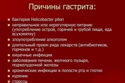 Гіперацидний гастрит симптоми і лікування (гіперацидний) Гіперацидний гастрит симптоми і лікування